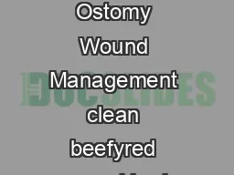 Ostomy Wound Management Pearls for Practice Ostomy Wound Management clean beefyred wound
