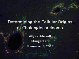 Determining the Cellular Origins of Cholangiocarcinoma