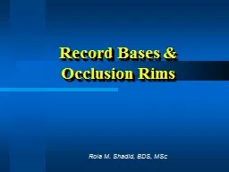 Record Bases & Occlusion Rims