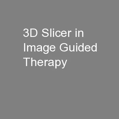 3D Slicer in Image Guided Therapy