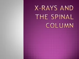 X-Rays and the spinal column