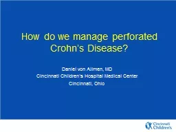 How do we manage perforated Crohn’s Disease?