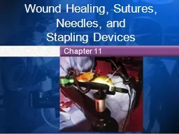 Wound Healing, Sutures, Needles, and