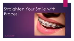 Straighten Your Smile with Braces!