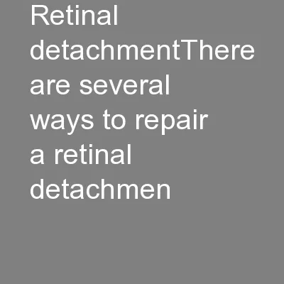 Retinal detachmentThere are several ways to repair a retinal detachmen