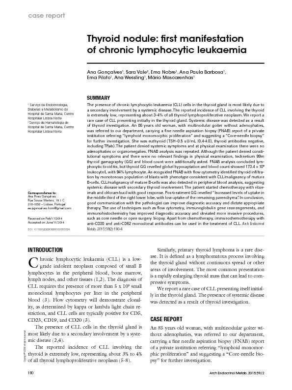 Thyroid nodule: rst manifestation of chronic lymphocytic leukaemiaAna