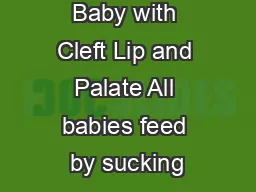 Feeding the Baby with Cleft Lip and Palate All babies feed by sucking