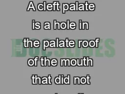 Cleft Palate  page  of  Cleft palate What is a cleft palate A cleft palate is a hole in