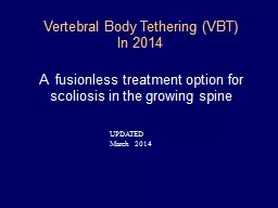 Vertebral Body Tethering (VBT)