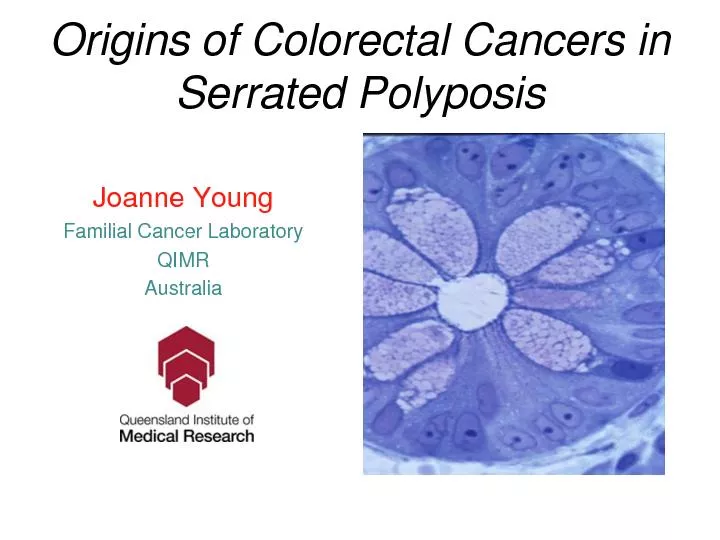 Origins of Colorectal Cancers in