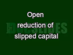 Open reduction of slipped capital