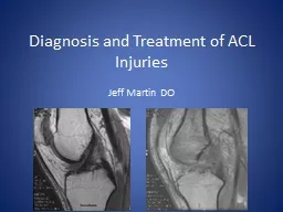 Diagnosis and Treatment of ACL Injuries