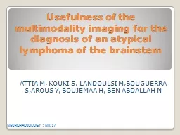 Usefulness of the multimodality imaging for the diagnosis o