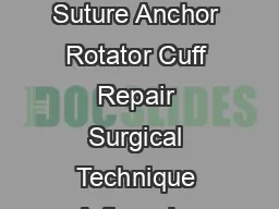BioCorkscrew Suture Anchor Rotator Cuff Repair Surgical Technique Arthrex Inc