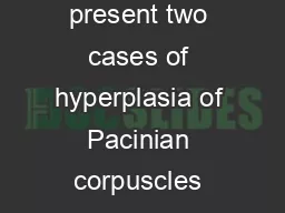 CASE REPORT The authors present two cases of hyperplasia of Pacinian corpuscles one in