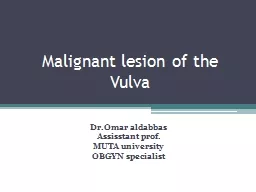 Malignant lesion of the Vulva