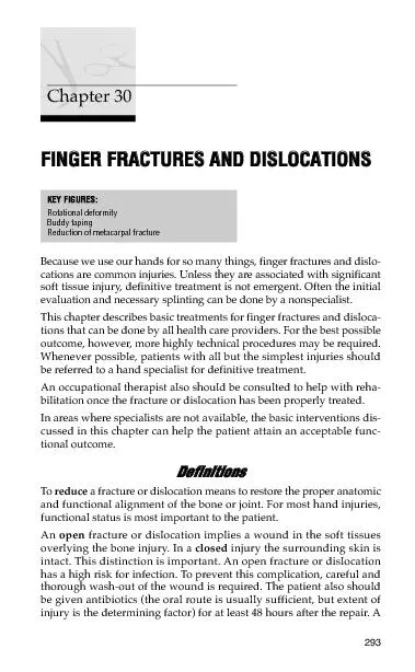 Finger Fractures and Dislocations295