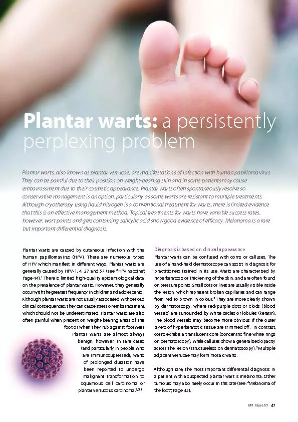 Plantar warts are caused by cutaneous infection with the human papillo