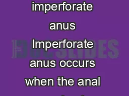Imperforate anus Page  of  Imperforate anus What is imperforate anus Imperforate anus