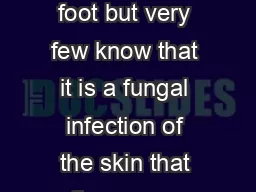 Most everyone has heard the term Athletes foot but very few know that it is a fungal infection of the skin that often occurs in runners cyclists and other athletes