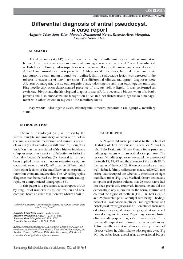 Stomatologija, Baltic Dental and Maxillofacial Journal, 2013, Vol. 15,