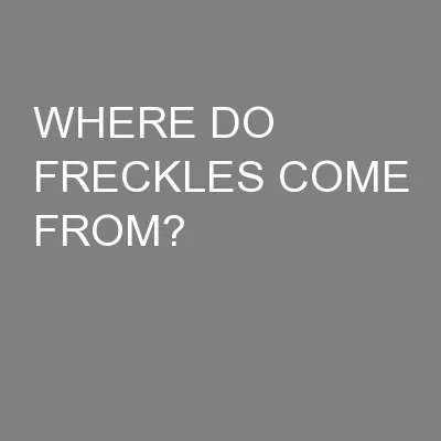 WHERE DO FRECKLES COME FROM?