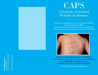 CAPSPeriodic SyndromesMuckle-Wells Syndrome (MWS)Authors: Karen L.W. D