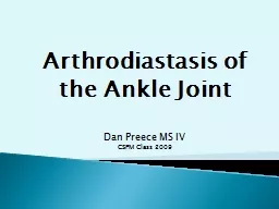 Arthrodiastasis of the Ankle Joint