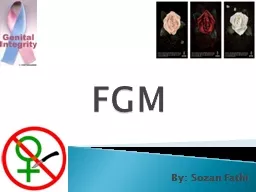 FGM By: