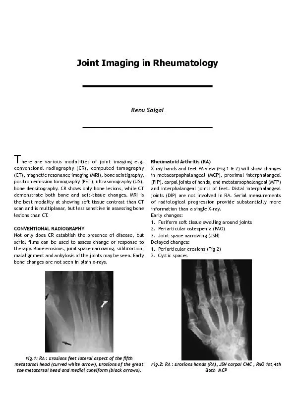 here are various modalities of joint imaging e.g. conventional radiogr