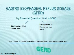 My Essential Question: What is GERD