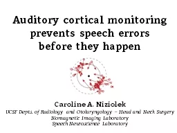 Auditory cortical