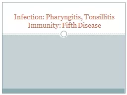 Infection: Pharyngitis, Tonsillitis