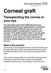 of  Corneal graft Transplanting the cornea in our eye