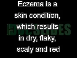 Eczema is a skin condition, which results in dry, flaky, scaly and red
