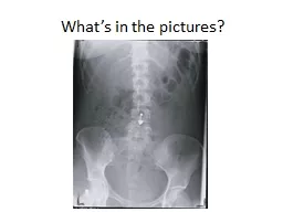 What’s in the pictures?