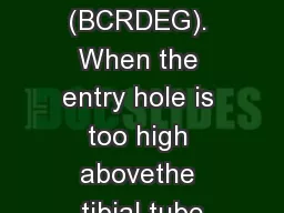 polygon (BCRDEG). When the entry hole is too high abovethe tibial tube