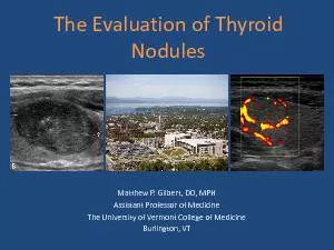 The Evaluation of Thyroid