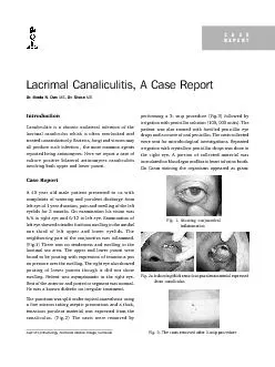 M. Chakrabarti et al. - Ocular Contusion Injury421