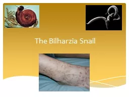 The Bilharzia Snail