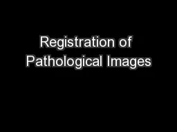 Registration of Pathological Images