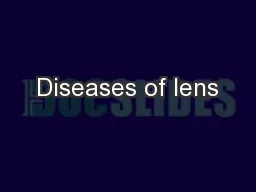 Diseases of lens