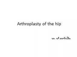 Arthroplasty of the hip