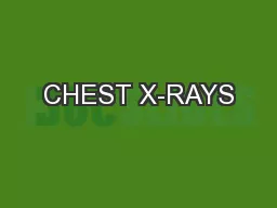 CHEST X-RAYS