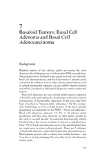Basaloid Tumors Basal Cell Adenoma and Basal Cell Aden