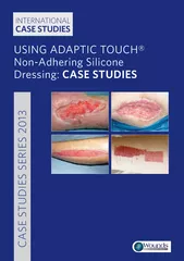 USING ADAPTIC TOUCH NonAdhering Silicone Dressing CASE
