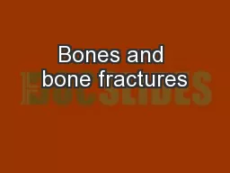 Bones and bone fractures