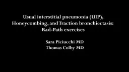 Usual interstitial pneumonia (UIP),