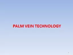 PALM VEIN TECHNOLOGY