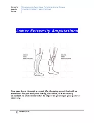 Lower Extremity Amputations You have been through a re